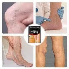2x1 Caja parches - VARICES