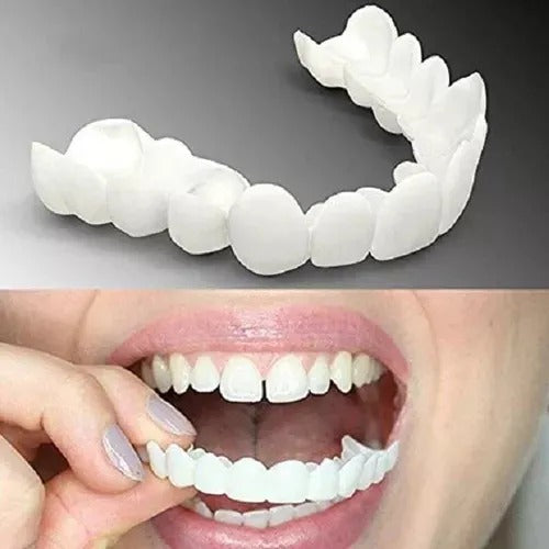 PLACA DENTAL CARILLAs SNAP ON SMILE